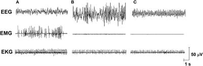 Neuroendocrine and Peptidergic Regulation of Stress-Induced REM Sleep Rebound